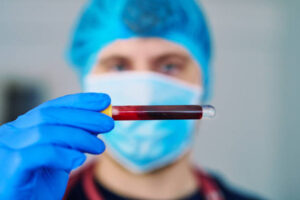 A gloved hand holds a blood sample tube.